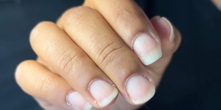 Une main aux ongles nus après une dépose Calgel® : la surface est lisse, sans stries ni zones blanchies.